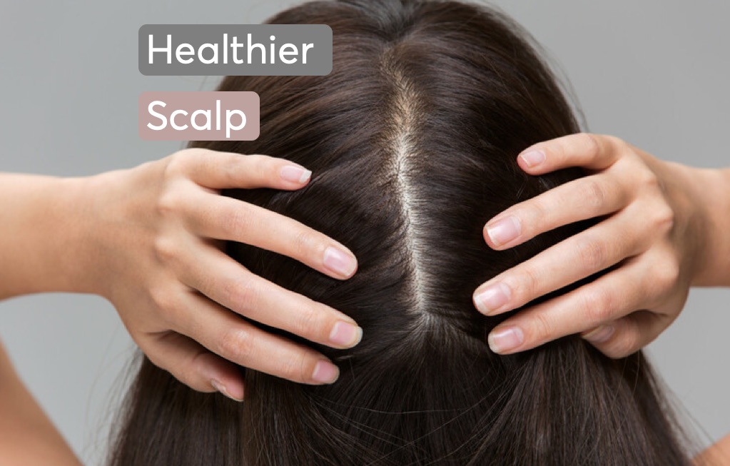 Top Methods to Reduce Scalp Inflammation and Promote Healthy Hair