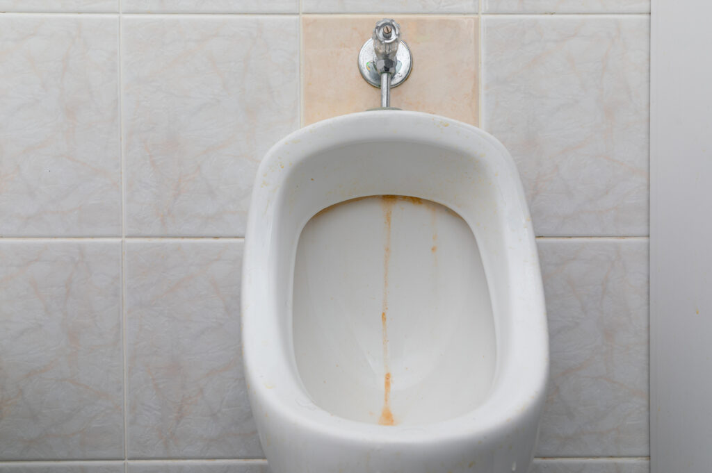 Understanding Urine Scale in Toilets: Causes and Prevention