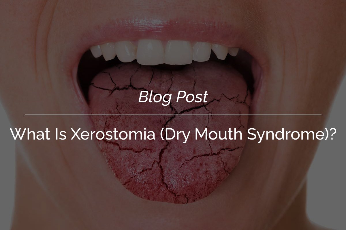 Xerostomia in COVID-19 Patients: What You Need to Know About Dry Mouth