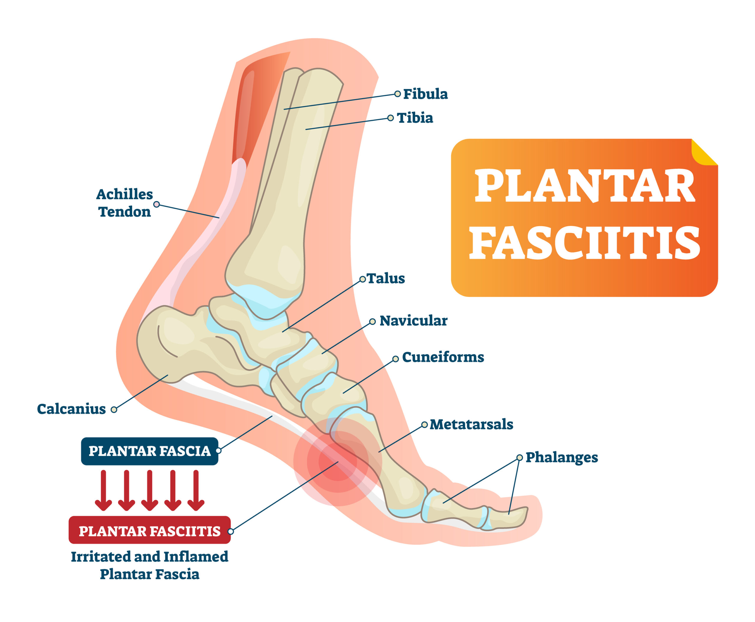 Ankle Pain After Waking Up: When to See a Doctor