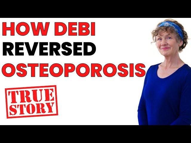 Reversing Osteoporosis: My Story on How I Reversed My Osteoporosis