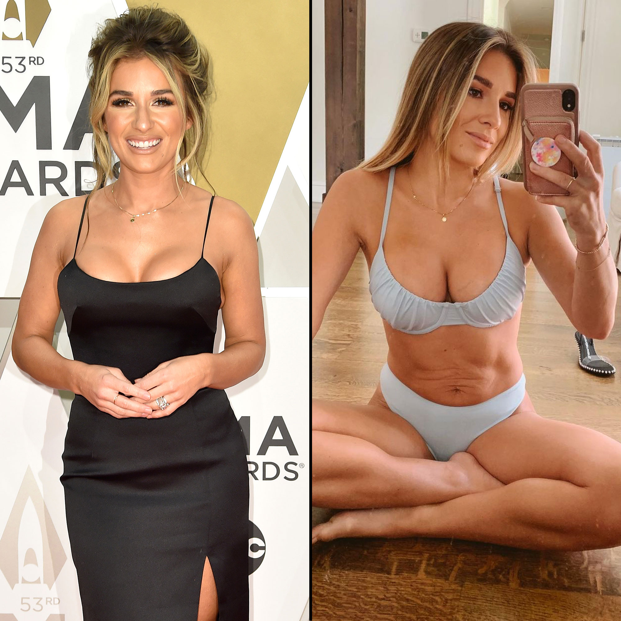 Unbelievable Celebrity Tummy Tuck Before and After Pictures Revealed