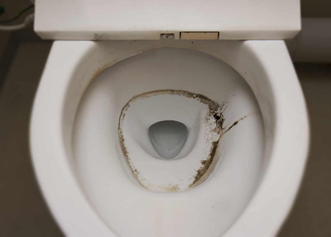 Uncovering the Mystery: Why Black Mold Grows in Toilets