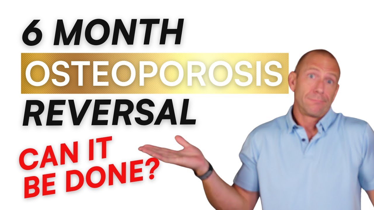 Reversing Osteoporosis: My Story on How I Reversed My Osteoporosis