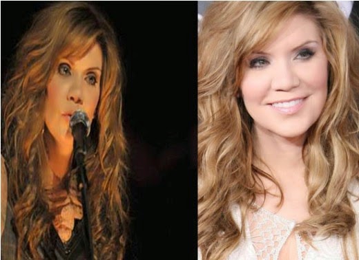 Exploring the Rumors: Alison Krauss and Plastic Surgery