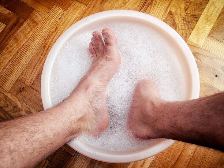 How to Use Bleach to Soak Athletes Foot Effectively