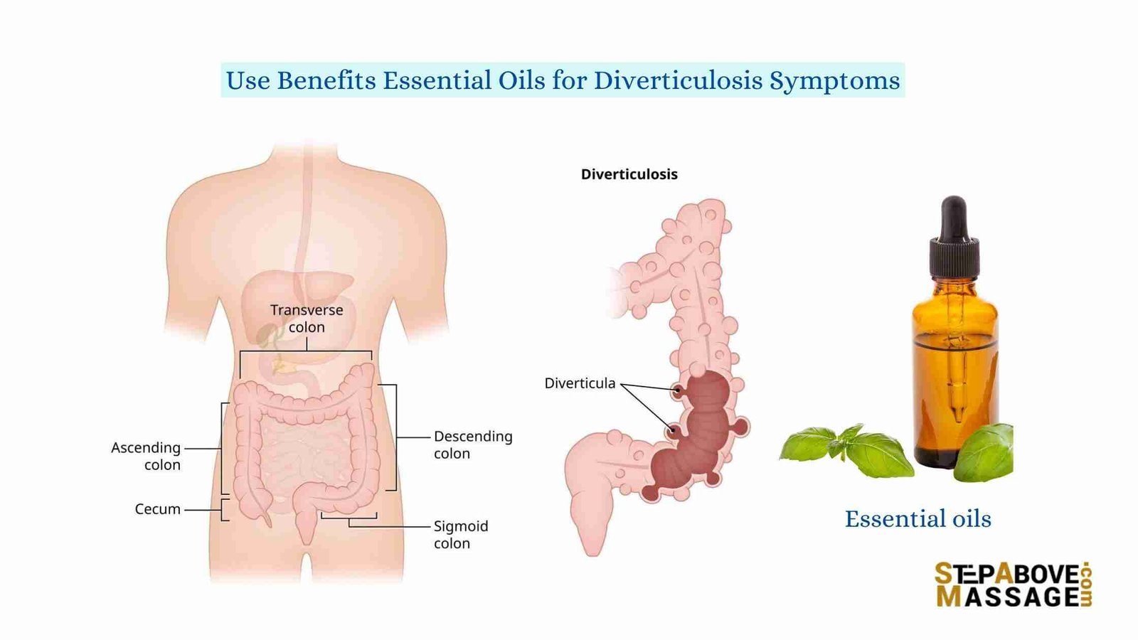 Essential Oil for Diverticulitis: Does It Really Work?