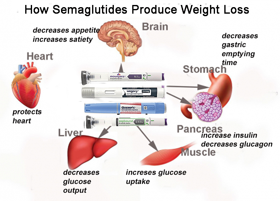 Zepbound and Keto Diet: Can You Combine Them for Weight Loss?