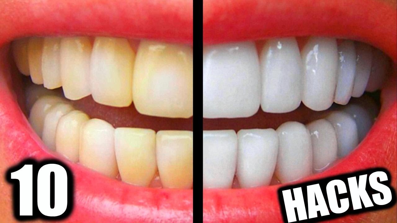 Want Whiter Teeth? Easy Tips and Tricks to Make It Happen